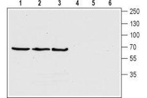 Western blot analysis of human SH-5YSY neuroblastoma cell lysate (lanes 1 and 4), rat (lanes 2 and 5) and mouse (lanes 3 and 6) brain lysates: - 1-3. (ChT anticorps  (4th Extracellular Loop))