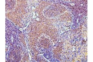 anti-Sialophorin (SPN) (AA 272-400) antibody