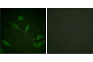 Immunofluorescence analysis of HeLa cells, using Keratin 18 (Phospho-Ser33) Antibody. (Cytokeratin 18 anticorps  (pSer34))