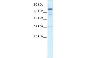 WB Suggested Anti-RIN3 Antibody Titration:  5. (RIN3 anticorps  (N-Term))