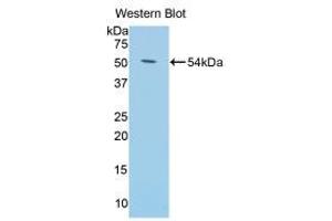 Western blot analysis of the recombinant protein. (Klotho anticorps  (AA 59-508))