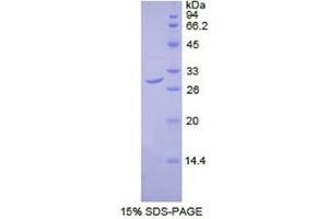 SDS-PAGE (SDS) image for Dihydrolipoyl Transacetylase (DLAT) (AA 374-631) protein (His tag) (ABIN2120966)