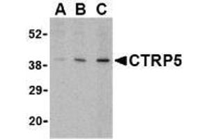 Western blot analysis of CTRP5 in caco-2 cell lysate with AP30255PU-N CTRP5 antibody at (A) 1, (B) 2, and (C) 4 μg/ml. (CTRP5 anticorps  (Intermediate Domain))