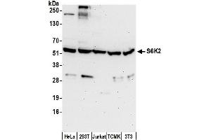 Western Blotting (WB) image for anti-Ribosomal Protein S6 Kinase, 70kDa, Polypeptide 2 (RPS6KB2) (C-Term) antibody (ABIN7452557)