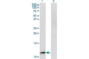 Western Blot analysis of RPP14 expression in transfected 293T cell line by RPP14 monoclonal antibody (M01A), clone 3H4. (RPP14 anticorps  (AA 1-75))