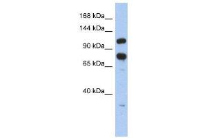 WB Suggested Anti-ZFR  Antibody Titration: 0. (ZFR anticorps  (Middle Region))