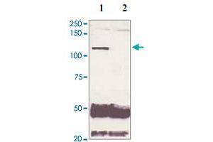 5 mg of the whole cell lysate derived from conditioned LNCaP were immunoprecipitated by 4 ug of AR (phospho S210) polyclonal antibody (Cat # PAB12654, lane 1) or pre adsorbed by immunization peptide (lane 2) followed by AR polyclonal antibody  at 1 : 500. (Androgen Receptor anticorps  (pSer210))