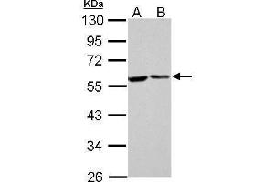 WB Image FKBP4 antibody detects FKBP4 protein by Western blot analysis.