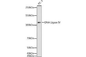 Western blot analysis of extracts of PC-3 cells, using DNA Ligase IV antibody (ABIN3022474, ABIN3022475, ABIN3022476 and ABIN6218843) at 1:1000 dilution. (LIG4 anticorps  (AA 612-911))
