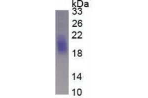 Image no. 2 for KIT Ligand (KITLG) (AA 25-191) (Active) protein (His tag) (ABIN6239749)