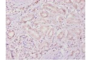 Immunohistochemistry of paraffin-embedded human kidney tissue using ABIN7159497 at dilution of 1:100 (TIMP4 anticorps  (AA 31-224))