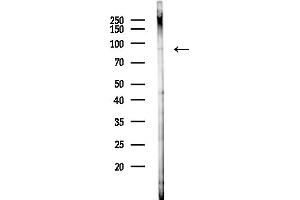 Western blot analysis of lysates from Hela cells(starvation,24h treatment), using SAR Antibody at 1/1000 dilution.