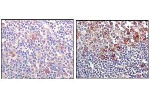 Immunohistochemical analysis of paraffin-embedded human lymph-node tissues (left) and human lymph follicle tissues (right), showing cytoplasmic and membrane localization using BTK mouse mAb with DAB staining. (BTK anticorps)