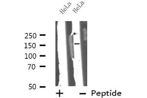 Western blot analysis of ZFYVE9 using HeLa whole cell lysates (ZFYVE9 anticorps  (C-Term))