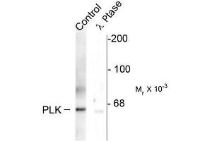 Image no. 1 for anti-Polo-Like Kinase 1 (PLK1) (pThr210) antibody (ABIN372703) (PLK1 anticorps  (pThr210))