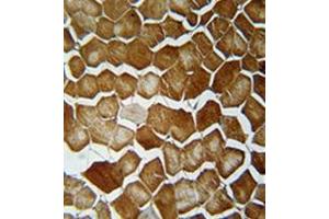 Immunohistochemistry analysis in formalin fixed and paraffin embedded human skeletal muscle reacted with ORMDL2 Antibody (Center) Cat.
