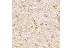 Immunohistochemistry of paraffin-embedded rat brain using MK4 Rabbit mAb (ABIN7268653) at dilution of 1:50 (40x lens). (MAP3K4 anticorps)