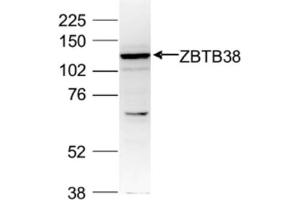 Western Blot of anti-ZBTB38 antibody Western Blot results of Rabbit anti-ZBTB38 antibody. (ZBTB38 anticorps  (C-Term, Internal Region))