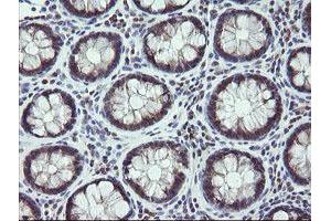 Image no. 3 for anti-Mitogen-Activated Protein Kinase Kinase 3 (MAP2K3) antibody (ABIN1499398)