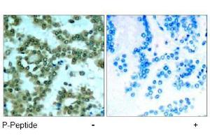 Image no. 1 for anti-Protein Kinase C, theta (PRKCQ) (pSer676) antibody (ABIN197070) (PKC theta anticorps  (pSer676))