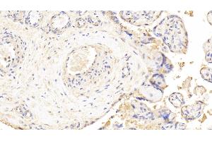 Detection of LDHB in Human Placenta Tissue using Polyclonal Antibody to Lactate Dehydrogenase B (LDHB)