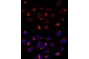 Immunofluorescence analysis of U-2 OS cells using TXNDC12 Polyclonal Antibody (ABIN7270800) at dilution of 1:100 (40x lens). (TXNDC12 anticorps  (AA 93-172))