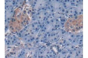 Detection of OAS2 in Human Pancreas Tissue using Polyclonal Antibody to 2',5'-Oligoadenylate Synthetase 2 (OAS2)