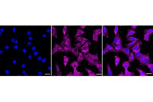 anti-Calcium/calmodulin-Dependent Protein Kinase I (CAMK1) antibody