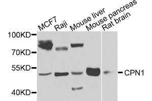 Western blot analysis of extracts of various cell lines, using CPN1 antibody (ABIN5974472) at 1/1000 dilution. (CPN1 anticorps)
