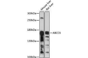 Western blot analysis of extracts of various cell lines, using  antibody (ABIN6134206, ABIN6136365, ABIN6136366 and ABIN6224126) at 1:1000 dilution. (ABCC6 anticorps  (AA 830-940))