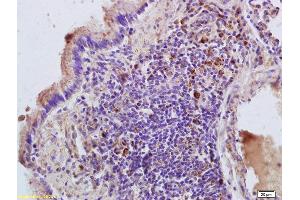 Formalin-fixed and paraffin embedded rat lung labeled with Anti-RHEB Polyclonal Antibody, Unconjugated (ABIN704771) at 1:200 followed by conjugation to the secondary antibody and DAB staining.