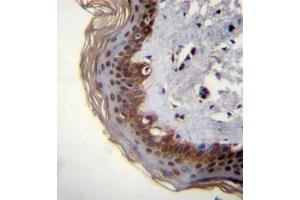 Formalin fixed, paraffin embedded human skin tissue stained with RBM42 Antibody (C-term) followed by peroxidase conjugation of the secondary antibody and DAB staining.