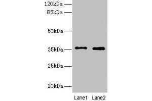 Western blot All lanes: FOXR2 antibody at 4 μg/mL Lane 1: SH-SY5Y whole cell lysate Lane 2: Hela whole cell lysate Secondary Goat polyclonal to rabbit IgG at 1/10000 dilution Predicted band size: 36 kDa Observed band size: 36 kDa (FOXR2 anticorps  (AA 1-300))