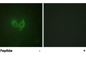 Immunofluorescence analysis of HUVEC cells, using MARK2 polyclonal antibody . (MARK2 anticorps)