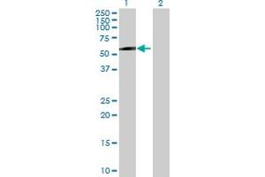 Western Blot analysis of MAGEC2 expression in transfected 293T cell line by MAGEC2 MaxPab polyclonal antibody. (MAGEC2 anticorps  (AA 1-373))
