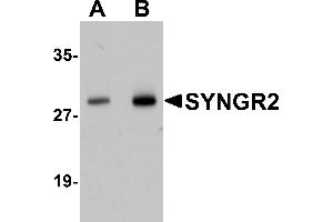 Western Blotting (WB) image for anti-Synaptogyrin 2 (SYNGR2) (N-Term) antibody (ABIN1031591) (SYNGR2 anticorps  (N-Term))