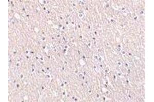 Immunohistochemical staining of CIDE-A in human brain tissue with CIDE-A antibody at 5μg/ml. (CIDEA anticorps  (AA 200-217))