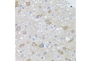 Immunohistochemistry of paraffin-embedded rat brain using  antibody (ABIN6129179, ABIN6136708, ABIN6136710 and ABIN6222176) at dilution of 1:100 (40x lens). (AKAP5 anticorps  (AA 1-270))