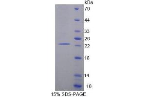 SDS-PAGE analysis of Human EIF2C1 Protein.