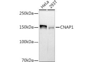 Western blot analysis of extracts of various cell lines, using (ABIN7268948) at 1:1000 dilution. (NCAPD2 anticorps)