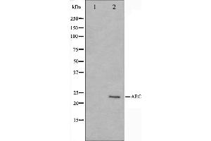 Western blot analysis on HeLa cell lysate using ARC Antibody,The lane on the left is treated with the antigen-specific peptide. (NOL3 anticorps  (C-Term))