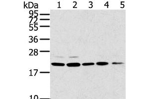 Western Blot analysis of 293T, 231, PC3, A549 and K562 cell using TPD52L1 Polyclonal Antibody at dilution of 1:300 (TPD52L1 anticorps)