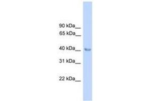 Image no. 1 for anti-Aminolevulinate Dehydratase (ALAD) (N-Term) antibody (ABIN6745534) (ALAD anticorps  (N-Term))