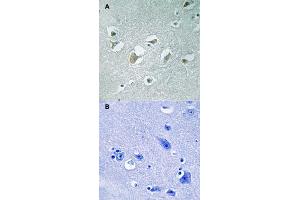 Immunohistochemical staining of human brain tissue by MAP3K9/MAP3K10 (phospho T312/266) polyclonal antibody  without blocking peptide (A) or preincubated with blocking peptide (B) under 1:50-1:100 dilution. (MAP3K9 anticorps  (pThr266, pThr312))