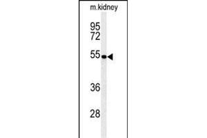 Western blot analysis of PCB Antibody (N-term) (ABIN651181 and ABIN2840115) in mouse kidney tissue lysates (35 μg/lane). (PMPCB anticorps  (N-Term))