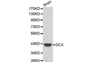 Western Blotting (WB) image for anti-Doublecortin (DCX) (AA 11-360) antibody (ABIN3021510) (Doublecortin anticorps  (AA 11-360))