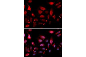 Immunofluorescence analysis of U2OS cells using RG antibody (ABIN6127968, ABIN6146621, ABIN6220915 and ABIN6220916).