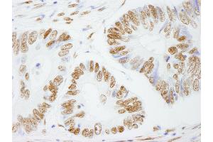 Immunohistochemistry (IHC) image for anti-Splicing Factor Proline/glutamine-Ric (SFPQ) (AA 657-707) antibody (ABIN7449003)