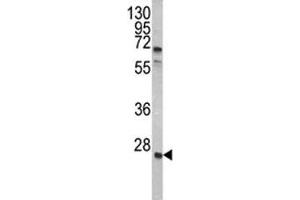 Western blot analysis of GRB2 antibody and A2058 lysate.