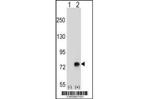 Western blot analysis of TGFBI using rabbit polyclonal TGFBI Antibody using 293 cell lysates (2 ug/lane) either nontransfected (Lane 1) or transiently transfected (Lane 2) with the TGFBI gene.